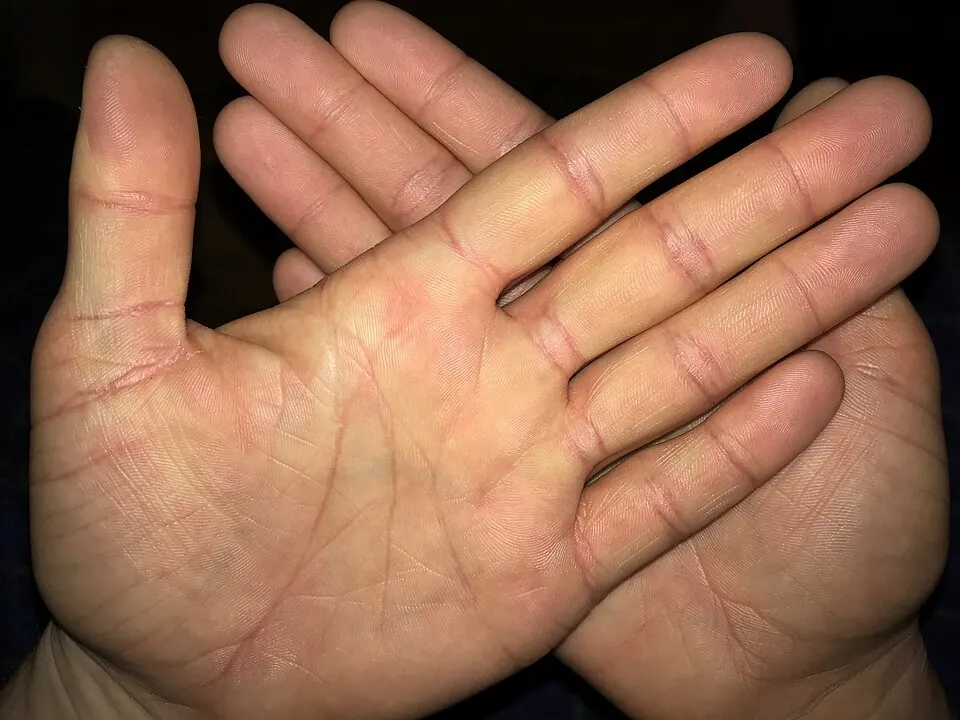 Close-up of an open palm showing a single straight crease running across the hand
